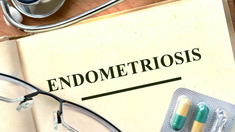 Endometrioza Cauze si tratamente